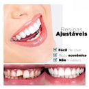 Nature Smile® - Facetas Dentárias Removíveis