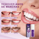 Clareador Dental V34 Original - Dentes Brancos Em Segundos - Nacional Shoppe