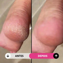 Removedor de Calos Elétrico Feet Cleaner