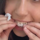 Facetas dentárias SmileFit: superior e inferior.(PAGUE 1 E LEVE 2)